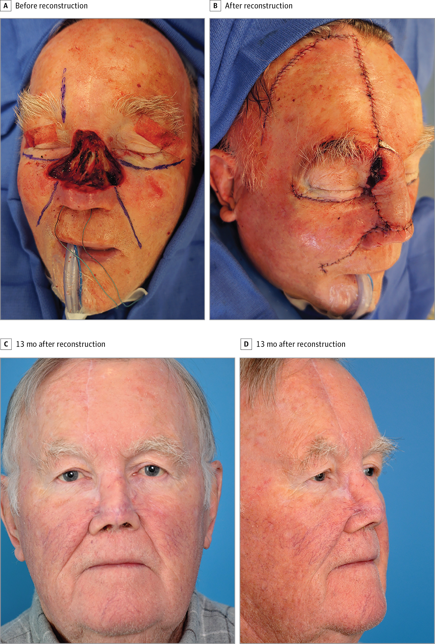 plastic and reconstructive surgery journal instructions for authors